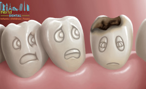 tooth decay world pediatric dental